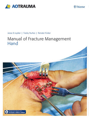 cover image of Manual of Fracture Management--Hand